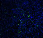 TLR3 Antibody in Immunohistochemistry (IHC)