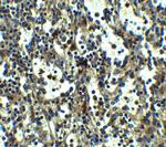 TLR3 Antibody in Immunohistochemistry (IHC)