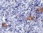 TLR3 Antibody in Immunohistochemistry (IHC)