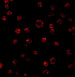 TLR3 Antibody in Immunocytochemistry (ICC/IF)