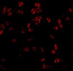 TLR5 Antibody in Immunocytochemistry (ICC/IF)