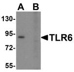 TLR6 Antibody in Western Blot (WB)