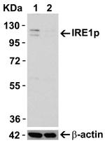 IRE1 alpha Antibody in Western Blot (WB)