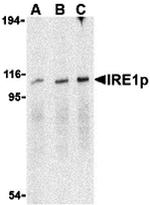 IRE1 alpha Antibody in Western Blot (WB)