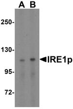 IRE1 alpha Antibody in Western Blot (WB)