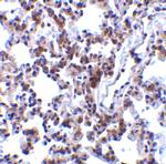 BAP31 Antibody in Immunohistochemistry (Paraffin) (IHC (P))