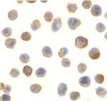 CTRP2 Antibody in Immunocytochemistry (ICC/IF)