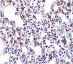 BAP31 Antibody in Immunohistochemistry (Paraffin) (IHC (P))