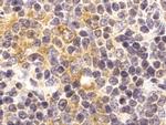 TLR9 Antibody in Immunohistochemistry (IHC)