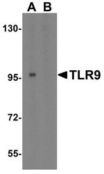 TLR9 Antibody in Western Blot (WB)