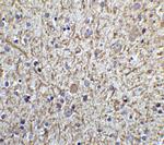 TOLLIP Antibody in Immunohistochemistry (IHC)