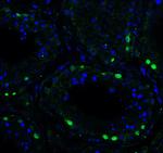 ATF6 Antibody in Immunocytochemistry (ICC/IF)