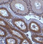 XBP1 Antibody in Immunohistochemistry (Paraffin) (IHC (P))