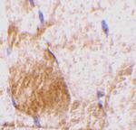 IL-31 Antibody in Immunohistochemistry (IHC)