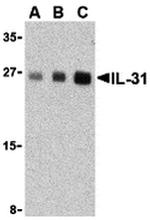 IL-31 Antibody in Western Blot (WB)