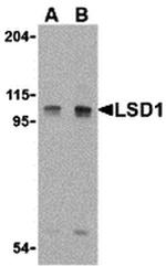 LSD1 Antibody in Western Blot (WB)