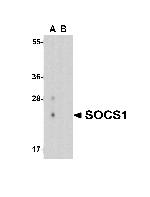 SOCS1 Antibody in Western Blot (WB)