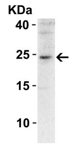 SOCS1 Antibody in Western Blot (WB)