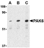 PAK6 Antibody in Western Blot (WB)