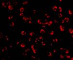 PAK7 Antibody in Immunocytochemistry (ICC/IF)