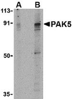 PAK7 Antibody in Western Blot (WB)