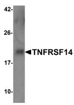 TNFRSF14 Antibody in Western Blot (WB)