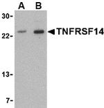 TNFRSF14 Antibody in Western Blot (WB)