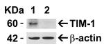 TIM-1 Antibody in Western Blot (WB)