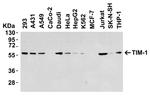 TIM-1 Antibody in Western Blot (WB)