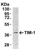 TIM-1 Antibody in Western Blot (WB)