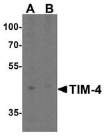 TIMD4 Antibody in Western Blot (WB)