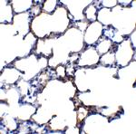 TRPC6 Antibody in Immunohistochemistry (IHC)