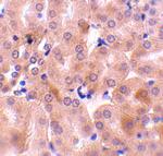 BCL2A1 Antibody in Immunohistochemistry (IHC)