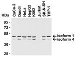 TIP47 Antibody in Western Blot (WB)