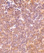 PAK2 Antibody in Immunohistochemistry (Paraffin) (IHC (P))