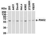 PAK2 Antibody in Western Blot (WB)