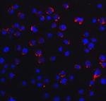 RIG-I Antibody in Immunocytochemistry (ICC/IF)