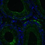 RIG-I Antibody in Immunohistochemistry (IHC)