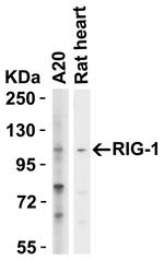 RIG-I Antibody in Western Blot (WB)