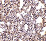 PKR Antibody in Immunohistochemistry (Paraffin) (IHC (P))