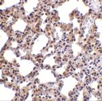 PKR Antibody in Immunohistochemistry (Paraffin) (IHC (P))