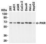 PKR Antibody in Western Blot (WB)