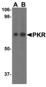 PKR Antibody in Western Blot (WB)