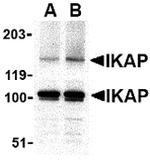 IKAP Antibody in Western Blot (WB)