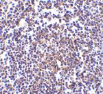 AVEN Antibody in Immunohistochemistry (IHC)