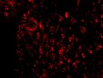 AVEN Antibody in Immunocytochemistry (ICC/IF)