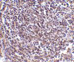 AVEN Antibody in Immunohistochemistry (IHC)