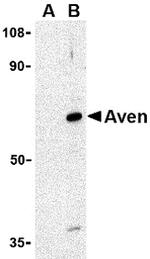 AVEN Antibody in Western Blot (WB)