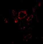 SLUG Antibody in Immunohistochemistry (IHC)