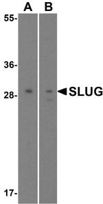 SLUG Antibody in Western Blot (WB)